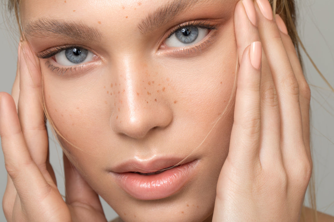 Is Hyaluronic Acid Good For Acne?