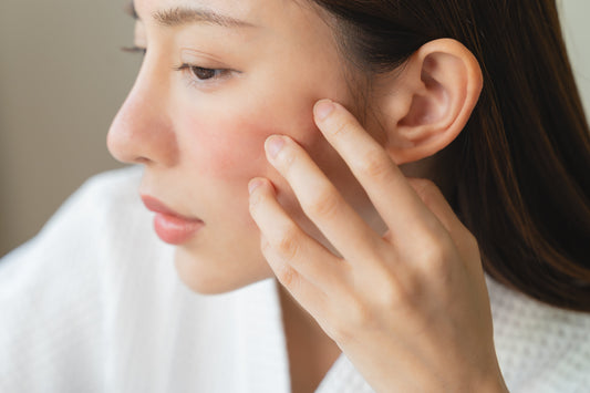Itchy Acne: Causes, Relief & When to See a Dermatologist