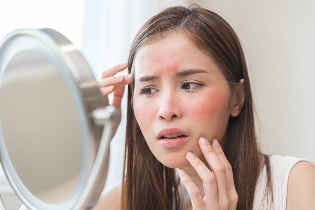 How To Treat Sun Poisoning: Quick Relief & Recovery Tips From A Skin Expert