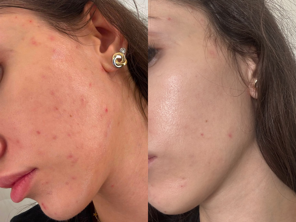 How to Tell If a "Sensitive Skin" Serum Is Actually Safe (A Skeptic's Checklist)