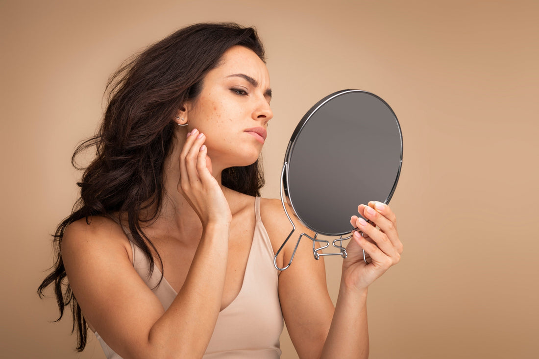fungal acne causes and treatment