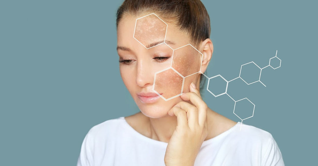 What Are Sun Spots on Skin: Causes and Dermatologist-Approved Ways to Treat Them