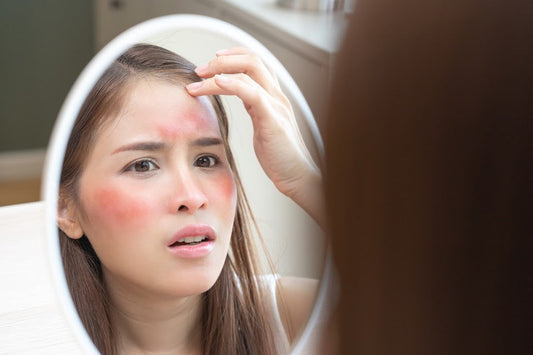 Sun Poisoning vs Sunburn: Differences, Symptoms, & Treatment